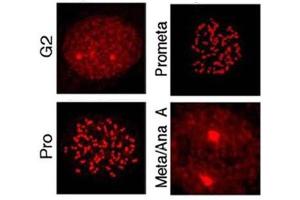 Immunostaining using  affinity purified anti-MLF1IP pT78 antibody shows detection of MLF1IP pT78 at the kinetochores of HeLa cells in different phases of the cell cycle. (MLF1IP 抗体  (pThr78))