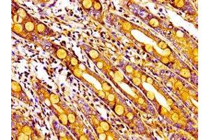 Immunohistochemistry of paraffin-embedded human small intestine tissue using ABIN7142689 at dilution of 1:100 (MPP1 抗体  (AA 123-252))