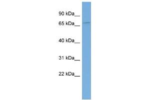 WB Suggested Anti-KIAA0907 Antibody Titration: 0. (KHDC4/BLOM7 抗体  (Middle Region))