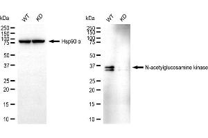 Western blotting analysis using N-acetylglucosamine kinase antibody (ABIN7799529). (NAGK 抗体)