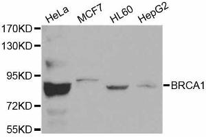 Western blot analysis of extracts of various cell lines, using BRCA1 antibody. (BRCA1 抗体  (AA 120-220))
