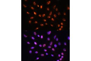 Immunofluorescence analysis of C6 cells using YY2 Rabbit pAb (ABIN7271429) at dilution of 1:100. (YY2 抗体  (AA 200-300))