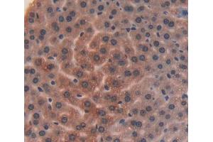 Used in DAB staining on fromalin fixed paraffin- embedded liver tissue (ITIH4 抗体  (AA 721-942))