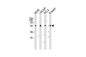 Western blot analysis of lysates from A549, LNCaP, PC-3 cell line and rat brain tissue lysate (from left to right), using ADRA1D Antibody (N-term) (ABIN1945085 and ABIN2838547). (ADRA1D 抗体  (N-Term))