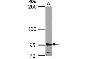 WB Image Sample (30 ug of whole cell lysate) A: 293T 5% SDS PAGE antibody diluted at 1:2000 (RRM1 抗体  (Center))