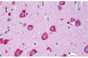 Anti-MLKL antibody IHC staining of human brain, cortex neurons. (MLKL 抗体  (AA 371-472))
