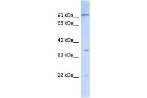 Host:  Rabbit  Target Name:  NIPSNAP3B  Sample Type:  Jurkat Whole Cell lysates  Antibody Dilution:  1. (NIPSNAP3B 抗体  (N-Term))