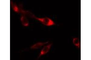 ABIN6274803 staining HepG2 cells by IF/ICC. (ACBD6 抗体  (Internal Region))