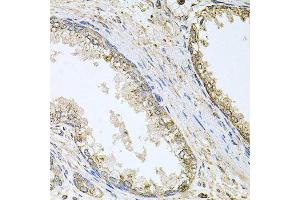 Immunohistochemistry of paraffin-embedded human prostate using CYP46A1 antibody (ABIN5996079) at dilution of 1/100 (40x lens). (CYP46A1 抗体)