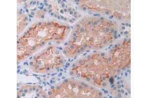 Used in DAB staining on fromalin fixed paraffin- embedded kidney tissue (TASP1 抗体  (AA 234-420))