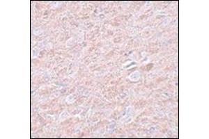 Immunohistochemistry of PRDM16 in rat brain tissue with AP30689PU-N PRDM16 antibody at 2. (PRDM16 抗体  (C-Term))