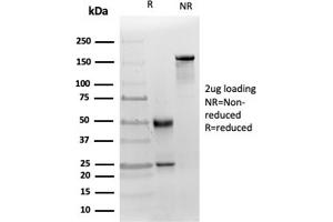SDS-PAGE Analysis Purified MICA Mouse Recombinant Monoclonal (MICA/4442). (MICA 抗体  (AA 1-200))
