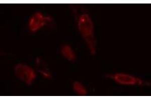 ABIN6275433 staining  COLO205 cells by IF/ICC. (CHML 抗体  (Internal Region))