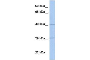 WB Suggested Anti-ART5 Antibody Titration:  0. (ART5 抗体  (Middle Region))