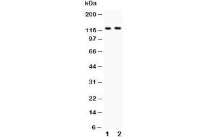 Western blot testing of BOC antibody and Lane 1:  mouse brain;  2: NIH3T3 lysate. (BOC 抗体  (AA 1002-1020))