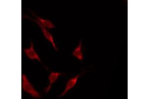 ABIN6267663 staining HeLa by IF/ICC. (LKB1 抗体  (pThr189))