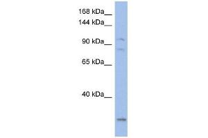 KCNQ5 antibody used at 1 ug/ml to detect target protein. (KCNQ5 抗体  (Middle Region))