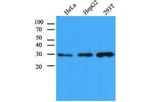 Western Blotting (WB) image for anti-Carbonyl Reductase 1 (CBR1) antibody (ABIN614308) (CBR1 抗体)