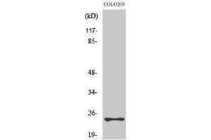 Western Blotting (WB) image for anti-Mediator Complex Subunit 18 (MED18) (Internal Region) antibody (ABIN3185507) (MED18 抗体  (Internal Region))