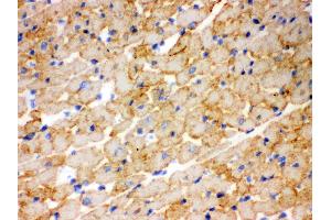 Immunohistochemistry (IHC) image for anti-Carnitine Palmitoyltransferase 1B (Muscle) (CPT1B) (AA 197-226), (N-Term) antibody (ABIN3042757)