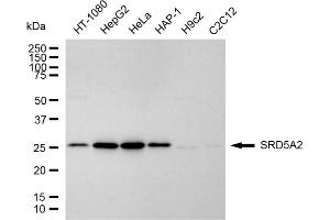 Western blotting analysis using SRD5A2 antibody (ABIN7800438).