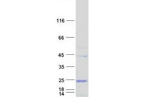 C9orf6 Protein (Myc-DYKDDDDK Tag)