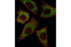 Immunofluorescence (IF) image for anti-Small Nuclear Ribonucleoprotein Polypeptide E (SNRPE) antibody (ABIN3003507) (SNRPE 抗体)