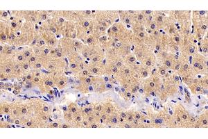 Detection of IGF1 in Human Liver Tissue using Monoclonal Antibody to Insulin Like Growth Factor 1 (IGF1)