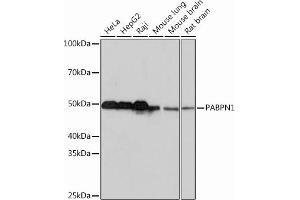 Western blot analysis of extracts of various cell lines, using P Rabbit mAb (ABIN7269445) at 1:1000 dilution. (PABPN1 抗体)