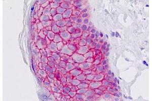 Human Skin, Epidermis: Formalin-Fixed, Paraffin-Embedded (FFPE) (EMP2 抗体  (AA 100-129))