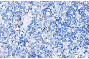 Immunohistochemistry (Paraffin-embedded Sections) (IHC (p)) image for anti-Mucosal Vascular Addressin Cell Adhesion Molecule 1 (MADCAM1) antibody (ABIN7010289)