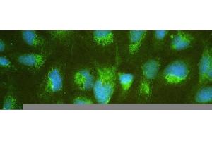 IF analysis of ALDH7A1 using anti-ALDH7A1 antibody (ABIN4886452).