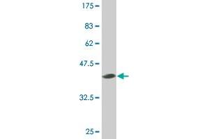 Western Blot detection against Immunogen (40. (SMO 抗体  (AA 653-787))