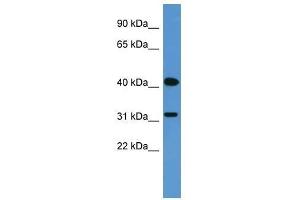 OR2W1 antibody used at 0. (OR2W1 抗体  (C-Term))