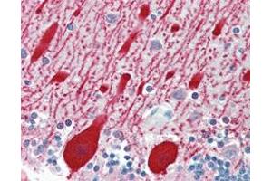 Immunohistochemical analysis of paraffin-embedded human brain cerebellum using AMACR mouse mAb. (AMACR 抗体)