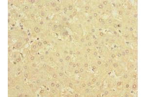 Immunohistochemistry of paraffin-embedded human liver tissue using ABIN7142304 at dilution of 1:100 (BDH2 抗体  (AA 1-245))
