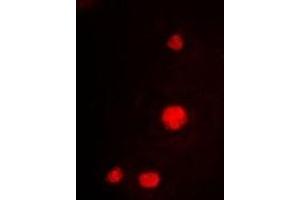 Immunofluorescent analysis of MCM3 staining in K562 cells. (MCM3 抗体)