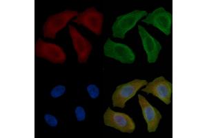 ABIN6264150 and ABIN6277603 staining Hela cells(45 min of heat-shock) by IF/ICC. (PEX19 抗体  (Internal Region))