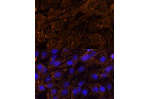 Immunofluorescence analysis of C6 cells using MMP3 Polyclonal Antibody (ABIN3021708, ABIN3021709, ABIN3021710 and ABIN6215578) at dilution of 1:100 (40x lens). (MMP3 抗体  (AA 248-477))