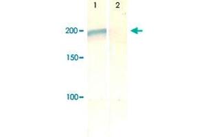 The cell lysate derived from conditioned NIH/3T3 was immunoprecipitated by IRS2 (phospho S731) polyclonal antibody , then immunoprobed by the same antibody at 1 : 500 (lane 1).