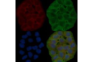 ABIN6264828 and ABIN6278632 staining Hela cells(30 min of UV treatment) by IF/ICC. (RPL14 抗体  (Internal Region))