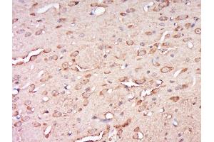 Paraformaldehyde-fixed, paraffin embedded rat brain, Antigen retrieval by boiling in sodium citrate buffer (pH6) for 15min, Block endogenous peroxidase by 3% hydrogen peroxide for 30 minutes, Blocking buffer (normal goat serum) at 37°C for 20min, Antibody incubation with Rabbit Anti-CCDC82 Polyclonal Antibody, Unconjugated  at 1:500 overnight at 4°C, followed by a conjugated secondary for 90 minutes and DAB staining. (CCDC82 抗体  (AA 301-400))