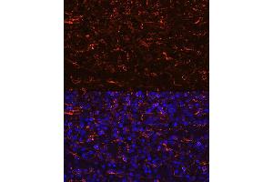 Immunofluorescence analysis of human spleen using CCR7 Rabbit mAb (ABIN7266309) at dilution of 1:100 (40x lens). (CCR7 抗体)