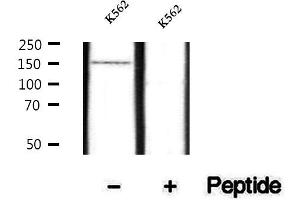 Western blot analysis of extracts of K562 cells, using Phospho-SHIP2 (Tyr986/987) Antibody. (INPPL1 抗体  (pTyr986, pTyr987))