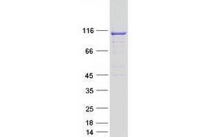 Validation with Western Blot (TBC1D2 Protein (Myc-DYKDDDDK Tag))
