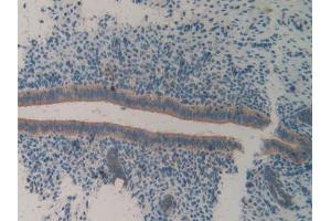 DAB staining on IHC-P; Samples: Mouse Uterus Tissue (ITGA2 抗体  (AA 212-370))