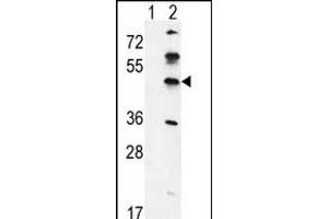 Western blot analysis of GK (arrow) using rabbit polyclonal GK Antibody (C-term) (ABIN651665 and ABIN2840349). (GKAP1 抗体  (C-Term))