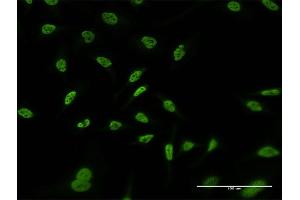 Immunofluorescence of monoclonal antibody to RERE on HeLa cell. (RERE 抗体  (AA 85-193))