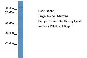Host: RabbitTarget Name: Adamts4Antibody Dilution: 1. (ADAMTS4 抗体  (N-Term))