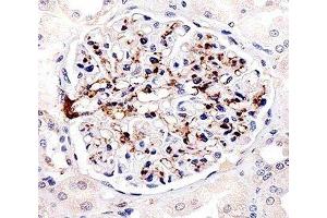 Immunohistochemical analysis of paraffin-embedded human kidney using FABP4 antibody at 1:25 dilution. (FABP4 抗体)